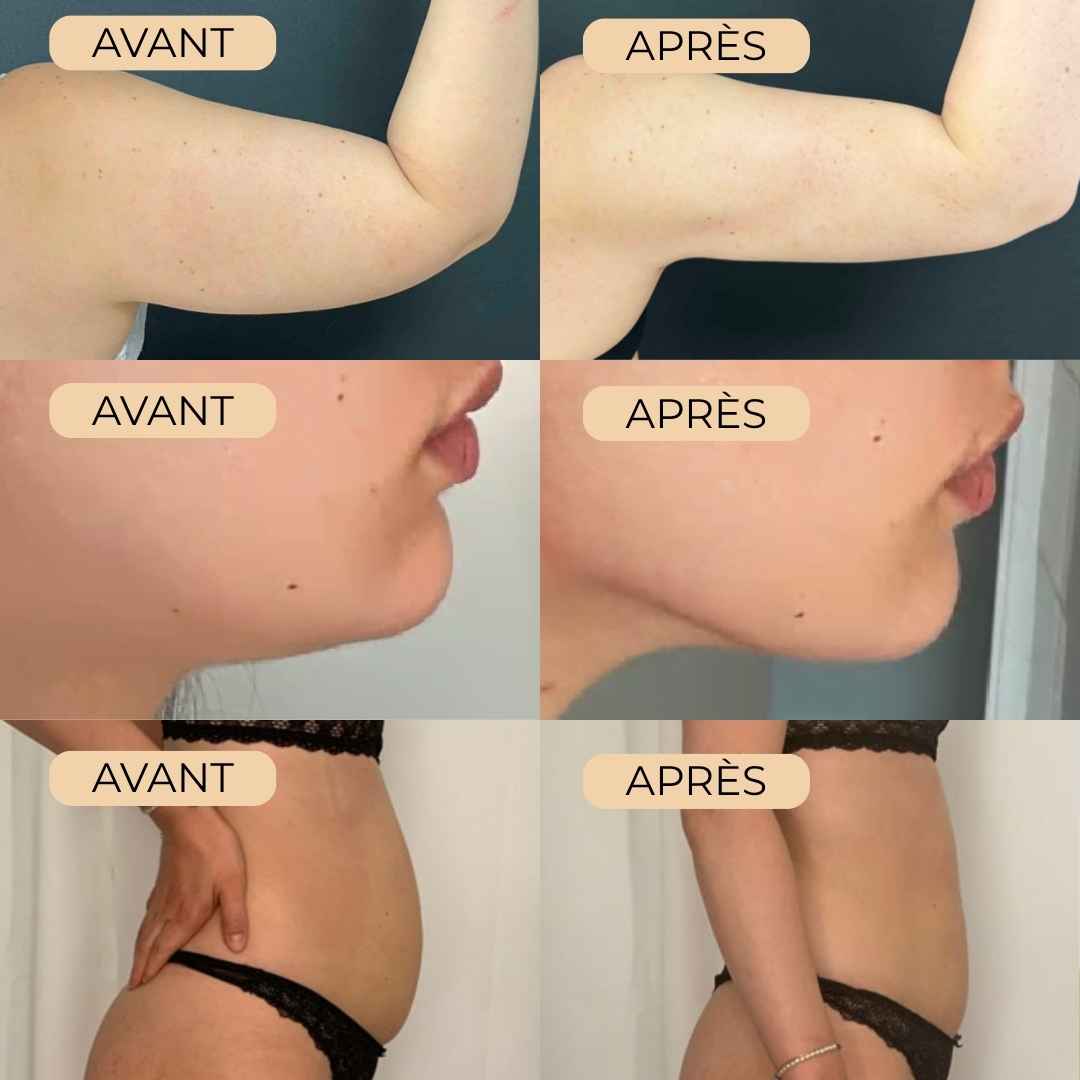 Drainant Lymphatique Naturel - Orvya