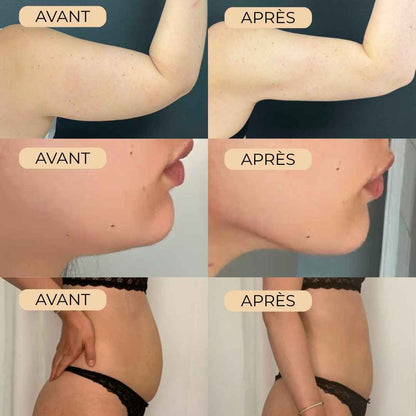 Drainant Lymphatique Naturel - Orvya